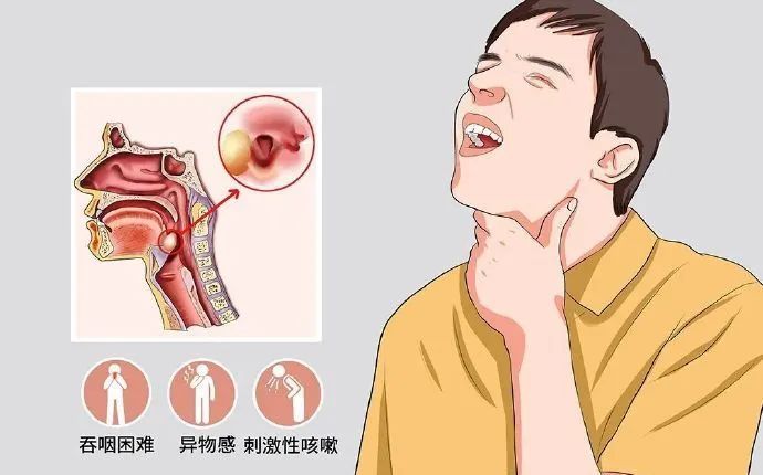 26岁女子吃完火锅嗓子疼,从就诊到去世仅10分钟!当心这种咽痛会致命!——上海热线侬好频道